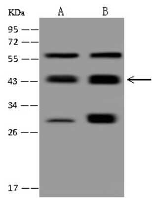 Western Blot: PP2C alpha/PPM1A Antibody [NBP3-00058]