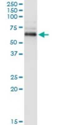 Immunoprecipitation: PP2C beta/PPM1B Antibody (1A3-2A4) [H00005495-M01]