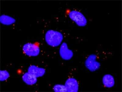 Proximity Ligation Assay: PP2C beta/PPM1B Antibody (1A3-2A4) [H00005495-M01]