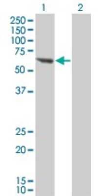 Western Blot: PP2C beta/PPM1B Antibody (1A3-2A4) [H00005495-M01]