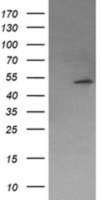 Western Blot: PP2C beta/PPM1B Antibody (OTI3C9)Azide and BSA Free [NBP2-73548]