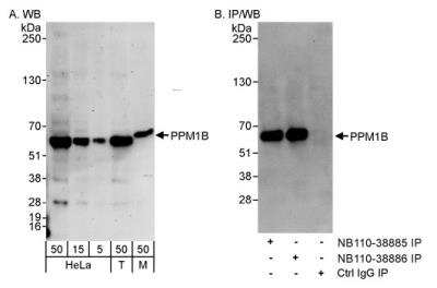 Western Blot: PP2C beta/PPM1B Antibody [NB110-38886]