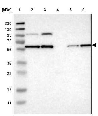 Western Blot: PP2C beta/PPM1B Antibody [NBP1-87250]