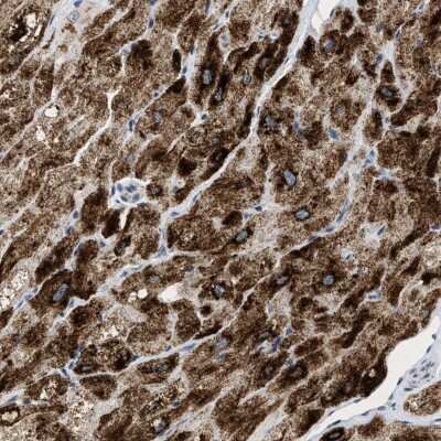 Immunohistochemistry-Paraffin: PP2C epsilon/PPM1L Antibody [NBP1-87247]
