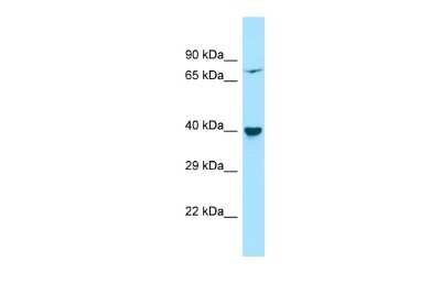 Western Blot: PP2C epsilon/PPM1L Antibody [NBP2-88077]