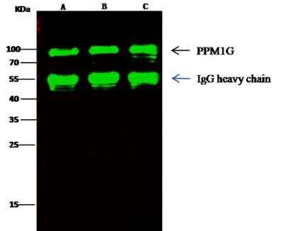 Immunoprecipitation: PP2C gamma/PPM1G Antibody (001) [NBP2-89857]