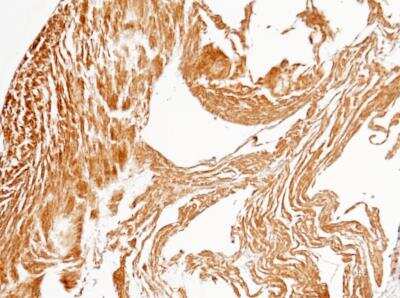 Immunohistochemistry-Paraffin: PP2C gamma/PPM1G Antibody (112) [NBP2-89858]
