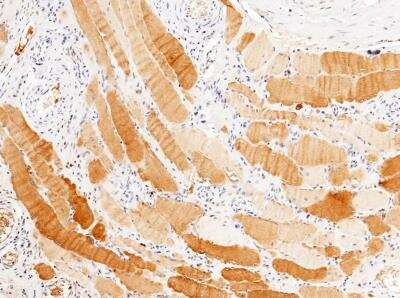 Immunohistochemistry-Paraffin: PP2C gamma/PPM1G Antibody (112) [NBP2-89858]