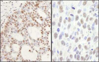 Immunohistochemistry: PP2C gamma/PPM1G Antibody [NB110-38867]