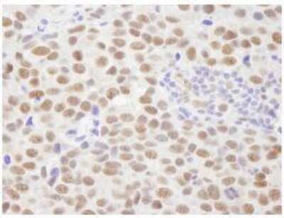 Immunohistochemistry-Paraffin: PP2C gamma/PPM1G Antibody [NB110-38867]