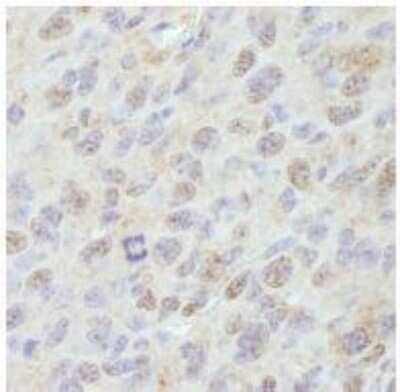 Immunohistochemistry-Paraffin: PP2C gamma/PPM1G Antibody [NB110-38867]