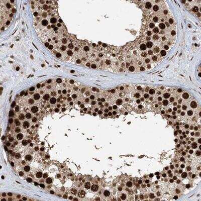 Immunohistochemistry-Paraffin: PP2C gamma/PPM1G Antibody [NBP1-87245]
