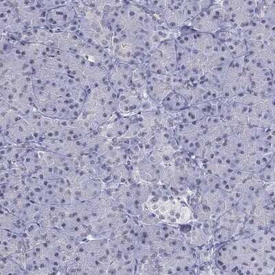 Immunohistochemistry-Paraffin: PP2C gamma/PPM1G Antibody [NBP1-87245]