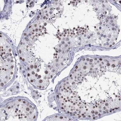 Immunohistochemistry-Paraffin: PP2C gamma/PPM1G Antibody [NBP1-87245]