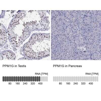 Immunohistochemistry-Paraffin: PP2C gamma/PPM1G Antibody [NBP1-87245]