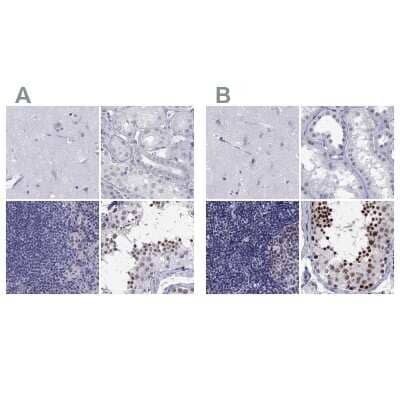 Immunohistochemistry-Paraffin: PP2C gamma/PPM1G Antibody [NBP1-87245]