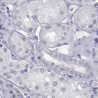 Immunohistochemistry-Paraffin: PP2C gamma/PPM1G Antibody [NBP1-87245]