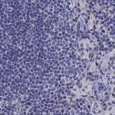 Immunohistochemistry-Paraffin: PP2C gamma/PPM1G Antibody [NBP1-87245]