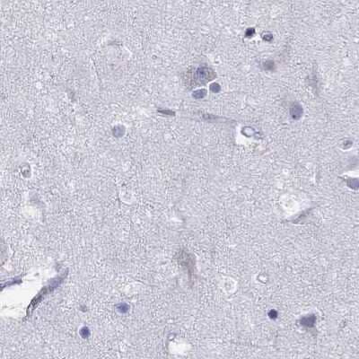 Immunohistochemistry-Paraffin: PP2C gamma/PPM1G Antibody [NBP1-87245]
