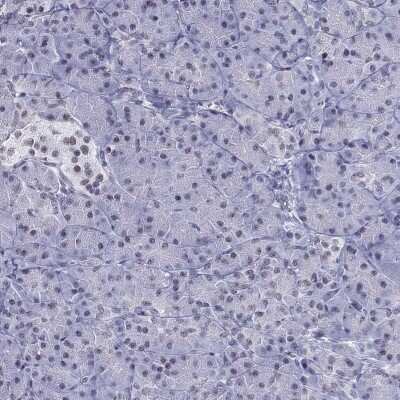 Immunohistochemistry-Paraffin: PP2C gamma/PPM1G Antibody [NBP1-87246]