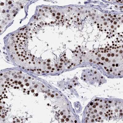 Immunohistochemistry-Paraffin: PP2C gamma/PPM1G Antibody [NBP1-87246]