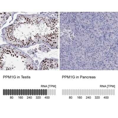 Immunohistochemistry-Paraffin: PP2C gamma/PPM1G Antibody [NBP1-87246]