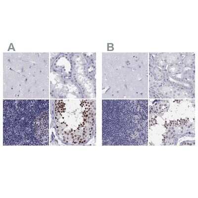 Immunohistochemistry-Paraffin: PP2C gamma/PPM1G Antibody [NBP1-87246]
