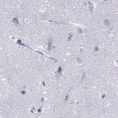 Immunohistochemistry-Paraffin: PP2C gamma/PPM1G Antibody [NBP1-87246]