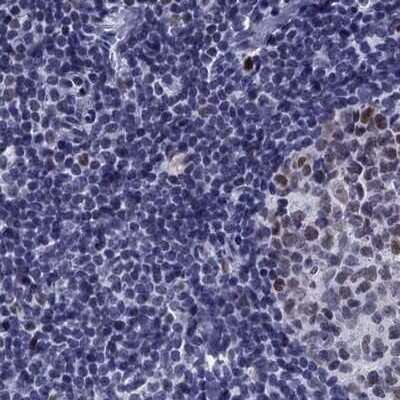 Immunohistochemistry-Paraffin: PP2C gamma/PPM1G Antibody [NBP1-87246]
