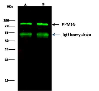 Immunoprecipitation: PP2C gamma/PPM1G Antibody [NBP2-99758]