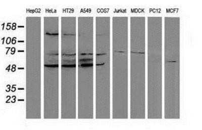 Western Blot: PP2C gamma/PPM1G Antibody (OTI1C12)Azide and BSA Free [NBP2-73552]