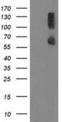 Western Blot: PP2C gamma/PPM1G Antibody (OTI1C12)Azide and BSA Free [NBP2-73552]