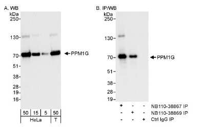 Western Blot: PP2C gamma/PPM1G Antibody [NB110-38867]