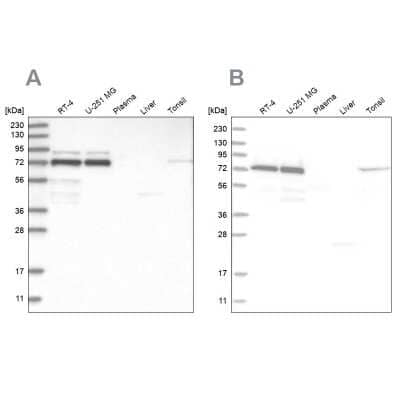 Western Blot: PP2C gamma/PPM1G Antibody [NBP1-87245]