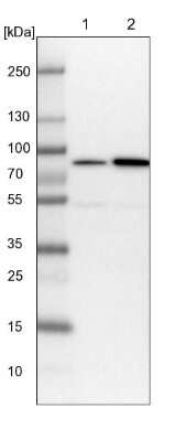 Western Blot: PP2C gamma/PPM1G Antibody [NBP1-87246]