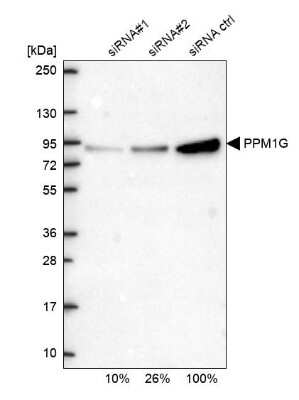 Western Blot: PP2C gamma/PPM1G Antibody [NBP1-87246]