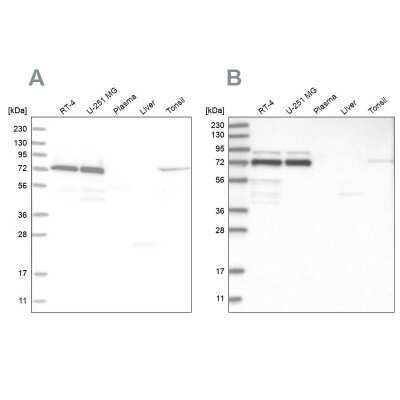Western Blot: PP2C gamma/PPM1G Antibody [NBP1-87246]