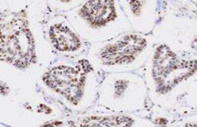 Immunohistochemistry-Paraffin: PP2C gamma/PPM1G Antibody (k1G6) - BSA Free [NBP1-04337]