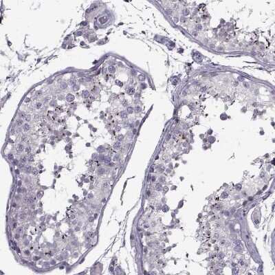 Immunohistochemistry-Paraffin: PP2D1 Antibody [NBP2-57748]