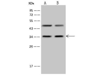 Western Blot: PP4/PPP4C Antibody [NBP2-99380]