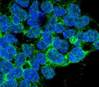 Immunocytochemistry/ Immunofluorescence: PP5 Antibody (12F7) [NBP2-59308]