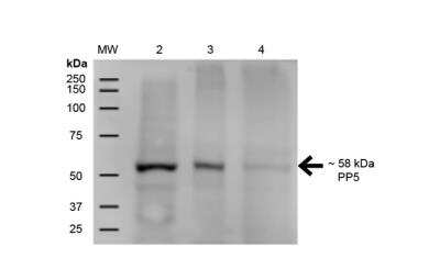 Western Blot: PP5 Antibody (12F7) [NBP2-59308]