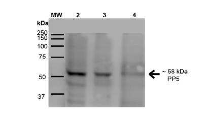 Western Blot: PP5 Antibody (2E11) [NBP2-59307]