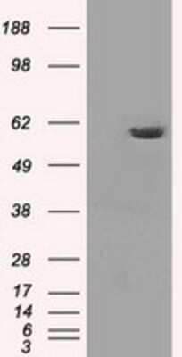 Western Blot: PP5 Antibody (OTI2E12) [NBP1-47927]