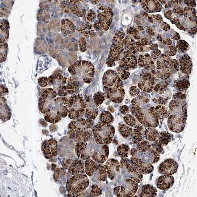 Immunohistochemistry-Paraffin: PP5 Antibody [NBP1-87240]