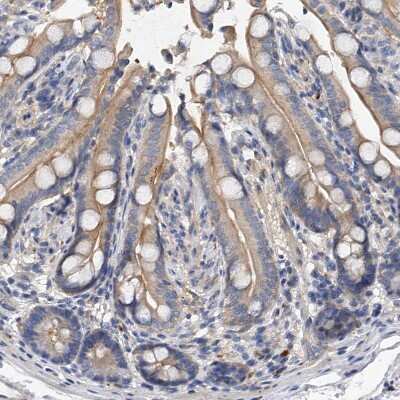 Immunohistochemistry-Paraffin: PP5 Antibody [NBP1-87240]
