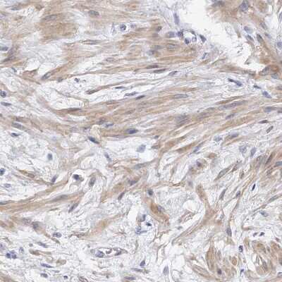 Immunohistochemistry-Paraffin: PP5 Antibody [NBP1-87240]