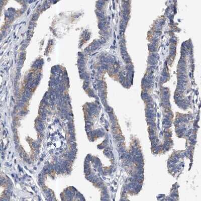 Immunohistochemistry-Paraffin: PP5 Antibody [NBP1-87240]
