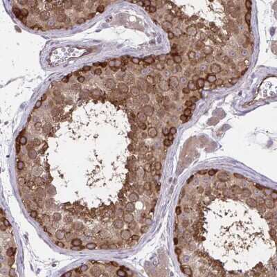 Immunohistochemistry-Paraffin: PP5 Antibody [NBP2-38812]
