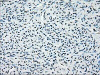 Immunohistochemistry: PP5 Antibody (OTI2E12) - Azide and BSA Free [NBP2-73555]